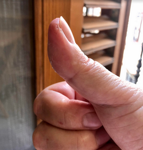 thumbs up