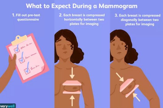 mammogram