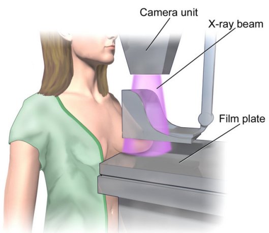 mammogram 2023