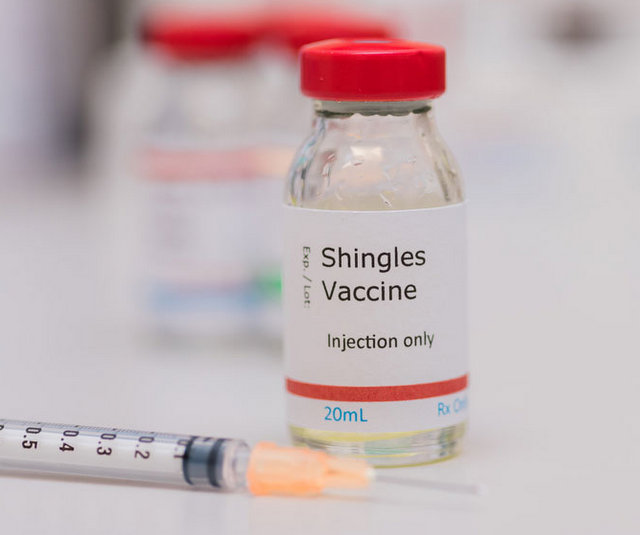 shingles
